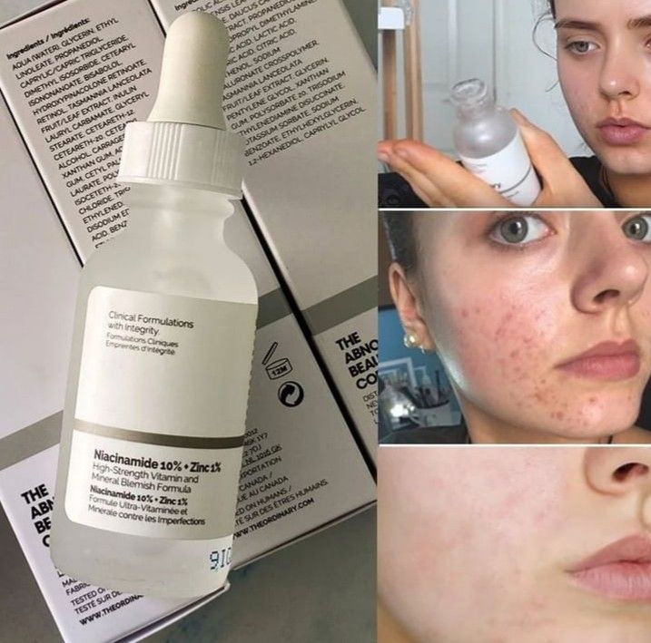Sérum de Niacinamida 10% + Zinc 1% | The Ordinary | 30 ml